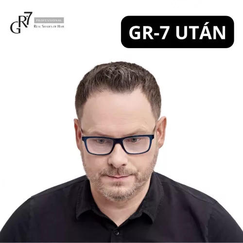 GR7 Professional Őszülés elleni hajápoló tonik 125ml
